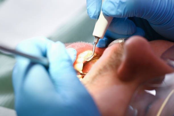 Best Emergency Broken Tooth Repair in Cedar Park, TX