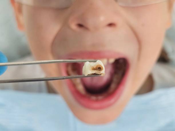 Best Emergency Treatment for Toothache in Cedar Park, TX